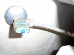 Zamena EK ventila Vračar